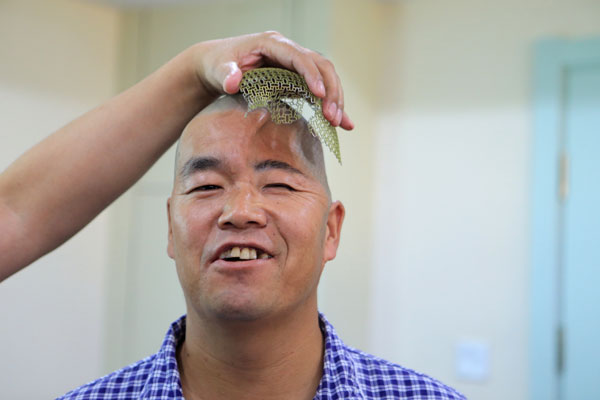 Man accepts a 3D-printed titanium half-skull