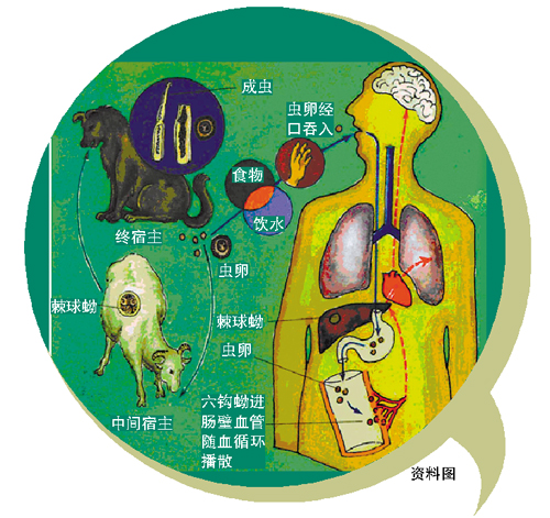 少女和寵物睡覺多年 遭蟲噬空骨頭癱瘓在床