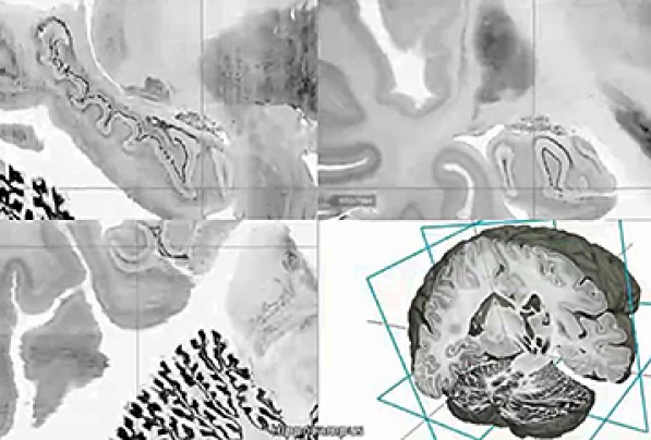 科學(xué)家繪制出3D人腦高清模型