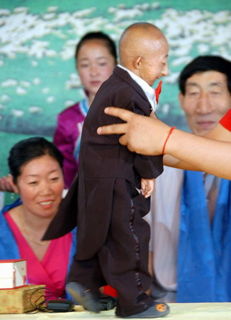 The world's shortest man dies in Rome