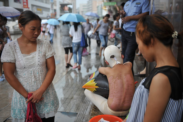 Burned boy begs for help in E China